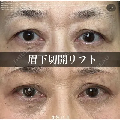 湘南美容クリニック 名古屋駅本院 豊嶋 沙良（育休中のため指名不可）医師の症例