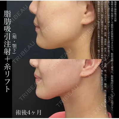湘南美容クリニック 名古屋駅本院 豊嶋 沙良（育休中のため指名不可）医師の症例
