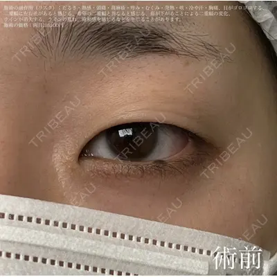 湘南美容クリニック 名古屋駅本院 豊嶋 沙良（育休中のため指名不可）医師の症例