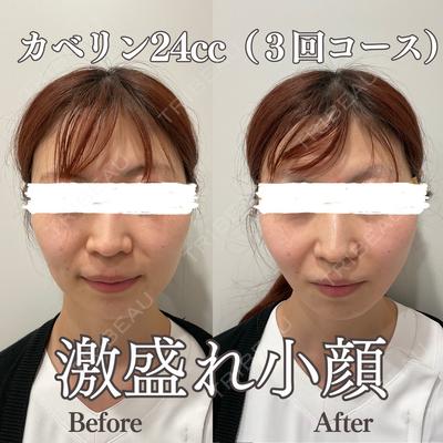 REVO CLINIC PLUS 結城 直哉医師の症例