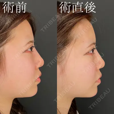 HAAB×DREAM BEAUTY CLINIC 大阪梅田院 柏木 太雅医師の症例