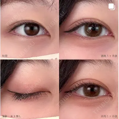 湘南美容クリニック 千葉センシティ院の症例