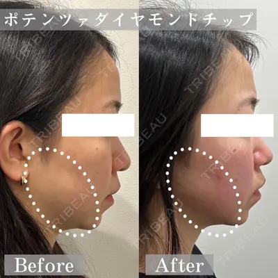 ARTE BEAUTY CLINICの症例