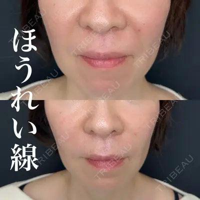 ルラ美容クリニック 新潟院の症例