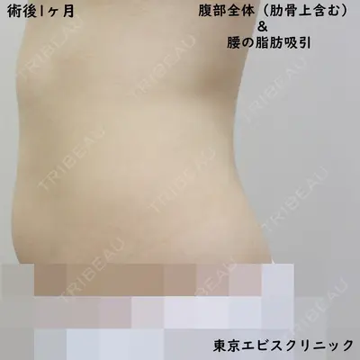 東京エビスクリニック 照屋 智医師の症例
