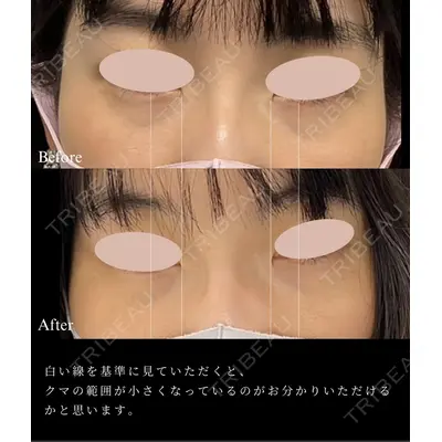 スマートスキンクリニック 神保町院の症例