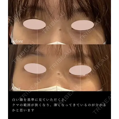 スマートスキンクリニック 神保町院の症例