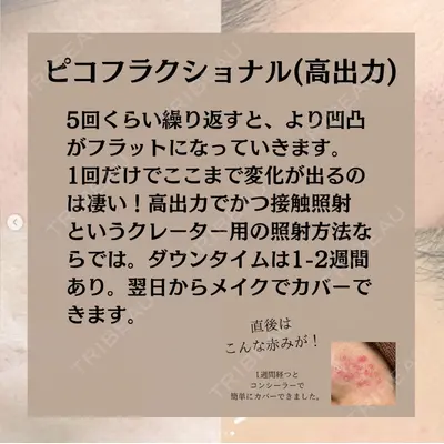 自由が丘ウェルエイジングビューティークリニック 福田 知佐子医師の症例