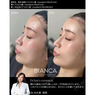 BIANCA表参道 大久保 由有医師の症例