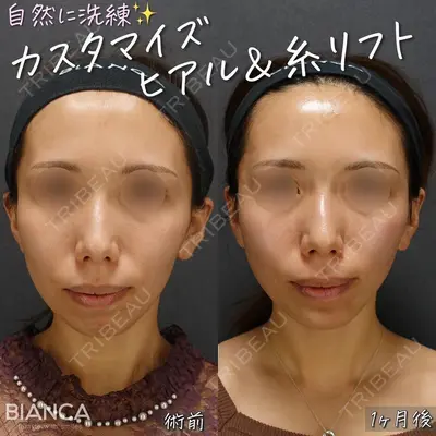 BIANCA表参道 大久保 由有医師の症例