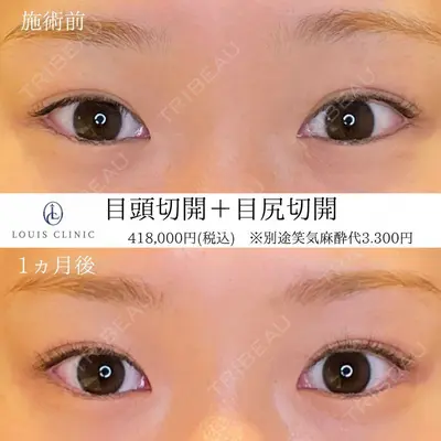 LOUIS CLINIC 二子玉川院【ルイクリニック】 小松 塁医師の症例