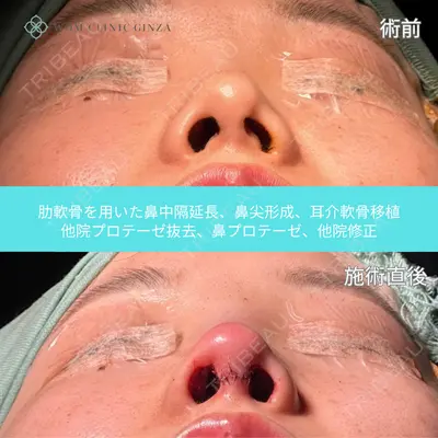 WOM CLINIC GINZA （ワム クリニック ギンザ） 中井 孝昌医師の症例