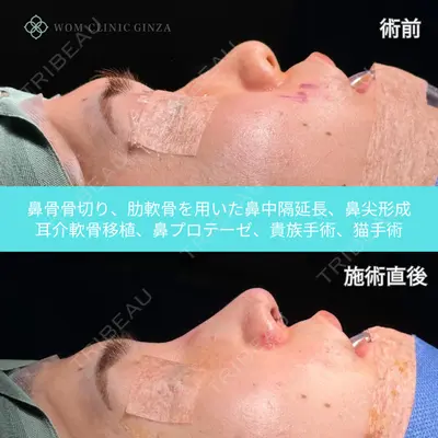 WOM CLINIC GINZA （ワム クリニック ギンザ） 中井 孝昌医師の症例