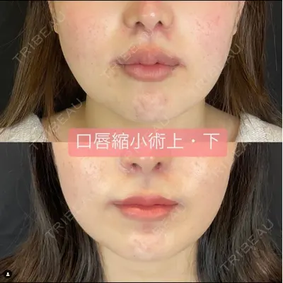 ルラ美容クリニック 新宿院 高木 欽之医師の症例