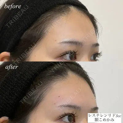 DMTC CLINIC 日本橋院 松井泉医師の症例