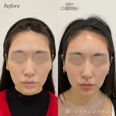 DMTC CLINIC 日本橋院 松井泉医師の症例
