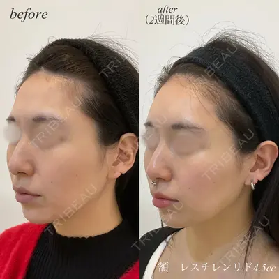 DMTC CLINIC 日本橋院 松井泉医師の症例