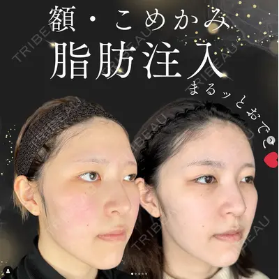 ルラ美容クリニック 池袋院 下川 洋輝医師の症例