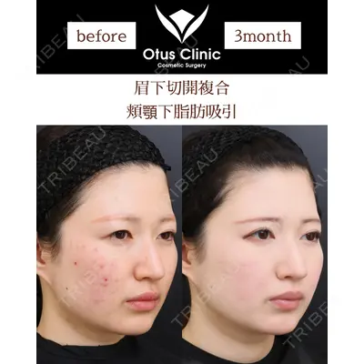 Otus Clinic 【オータスクリニック】 中 徳太郎医師の症例