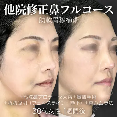ジョウクリニック 銀座院 重本　譲医師の症例
