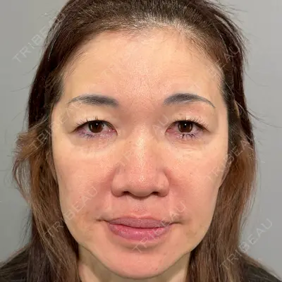 PRISM Beauty Clinic 新宿院 畑山 知輝医師の症例