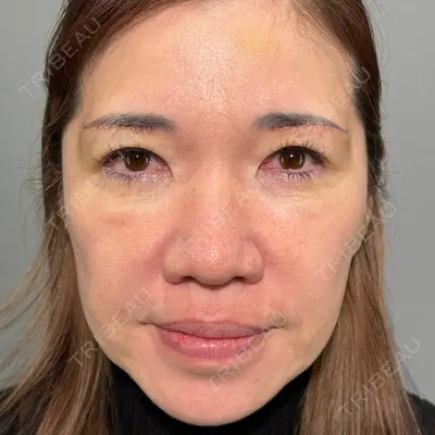 PRISM Beauty Clinic 新宿院 畑山 知輝医師の症例