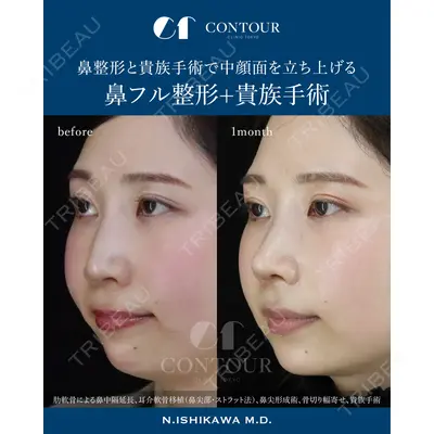 コントアクリニック 東京 石川 菜緒医師の症例