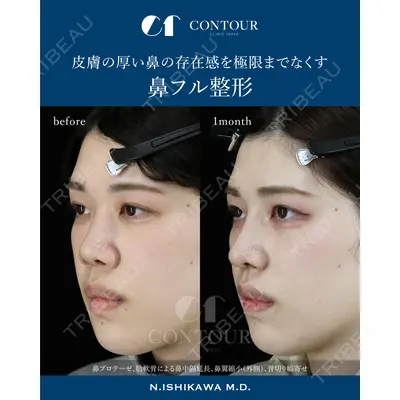 コントアクリニック 東京 石川 菜緒医師の症例