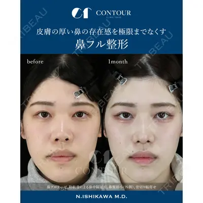 コントアクリニック 東京 石川 菜緒医師の症例