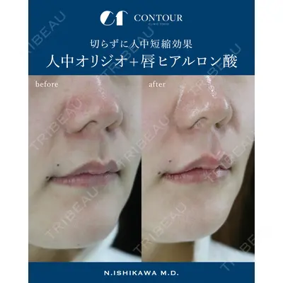 コントアクリニック 東京 石川 菜緒医師の症例