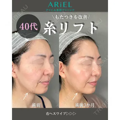 アリエル美容クリニック 大宮院 鈴木　桂介医師の症例