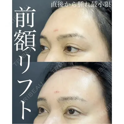 ルラ美容クリニック 渋谷本院 武内 大医師の症例