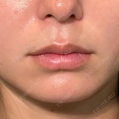 PRISM Beauty Clinic 新宿院 畑山 知輝医師の症例