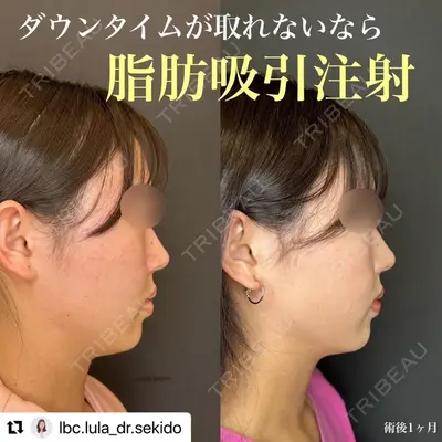 ルラ美容クリニック 名古屋栄院 / ルラスキンクリニック 名古屋栄院 関戸 優医師の症例