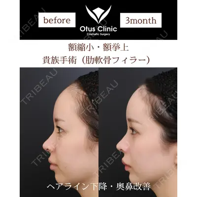 Otus Clinic 【オータスクリニック】 中 徳太郎医師の症例
