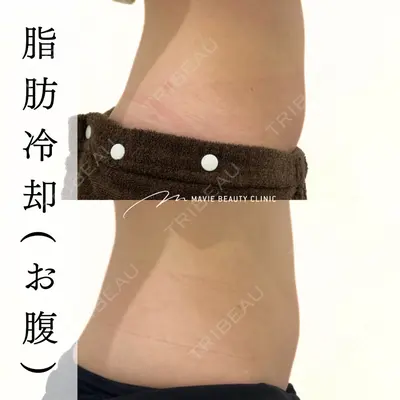 Mavie Beauty Clinic （マヴィービューティークリニック）の症例