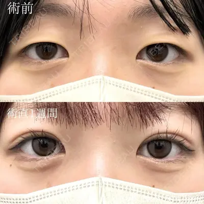 ネビュラクリニック 東京錦糸町院の症例