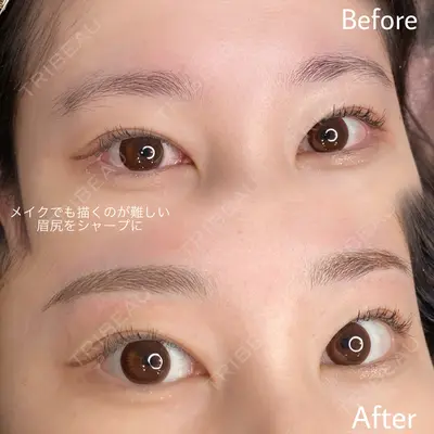 LEAGRANT CLINIC 中目黒 中村 未咲医師の症例