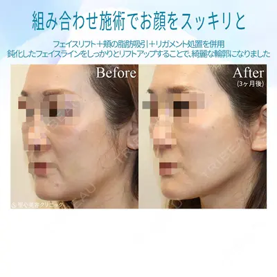 聖心美容クリニック 銀座院 牧野 陽二郎医師の症例