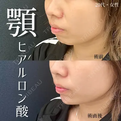 東京シンデレラ美容外科 大宮院の症例