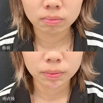 東京シンデレラ美容外科 大宮院の症例