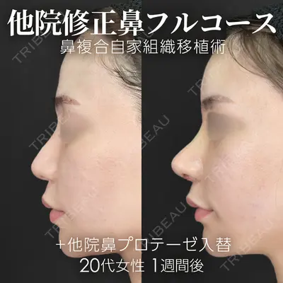 ジョウクリニック 銀座院 重本　譲医師の症例
