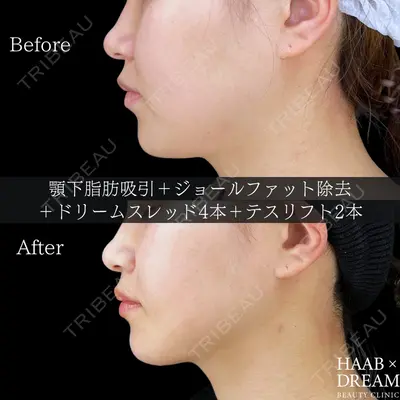 HAAB BEAUTY CLINIC 南青山本院（新院） 金子 雄医師の症例