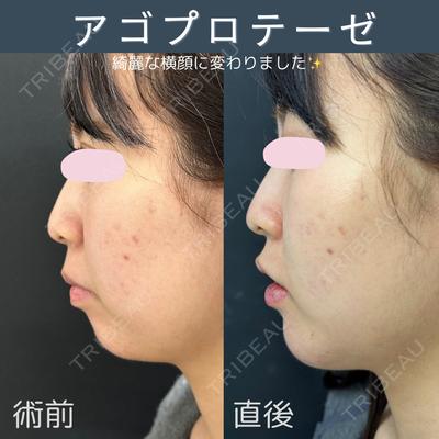 ルラ美容クリニック 仙台院 / ルラスキンクリニック 仙台院 橋本 英樹医師の症例