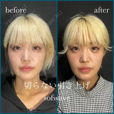 THE FIRST CLINIC 町田院 惟村 公郁医師の症例