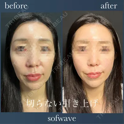 THE FIRST CLINIC 町田院 惟村 公郁医師の症例