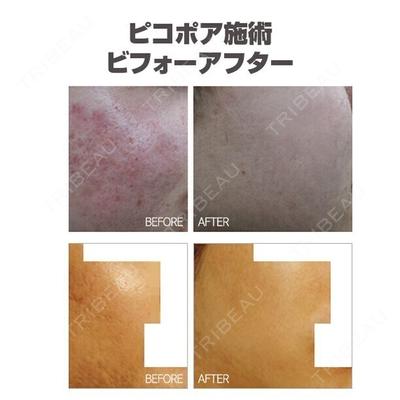 童顔中心クリニックの症例