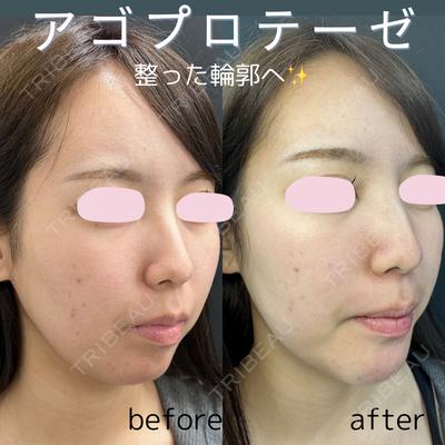 ルラ美容クリニック 仙台院 / ルラスキンクリニック 仙台院 橋本 英樹医師の症例