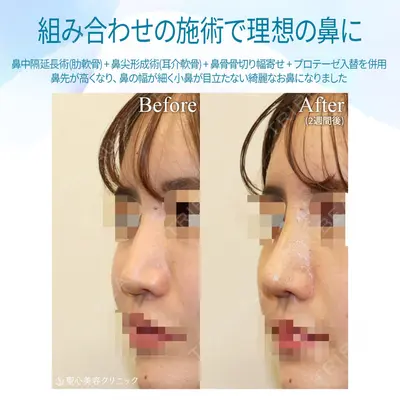 聖心美容クリニック 銀座院 牧野 陽二郎医師の症例