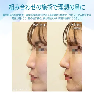聖心美容クリニック 銀座院 牧野 陽二郎医師の症例